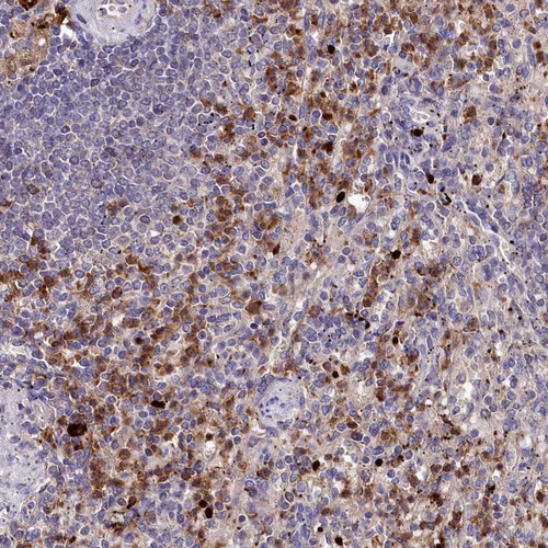 Immunohistochemical staining of human spleen shows moderate to strong membranous/ cytoplasmic positivity in cells in red pulp. Immunohistochemical staining of human spleen shows moderate to strong membranous/ cytoplasmic positivity in cells in red pulp.