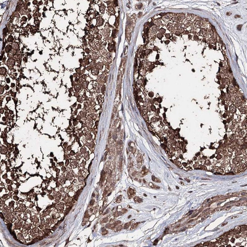 Immunohistochemical staining of human testis shows cytoplasmic positivity in cells in seminiferous ducts and Leydig cells.