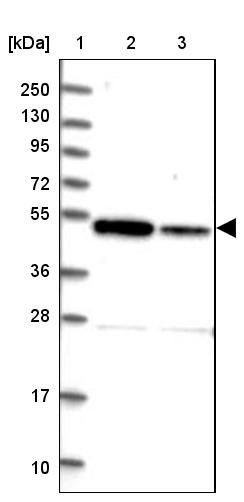 Lane 1: Marker [kDa] 250, 130, 95, 72, 55, 36, 28, 17, 10<br/>Lane 2: Human cell line RT-4<br/>Lane 3: Human cell line U-251MG sp
