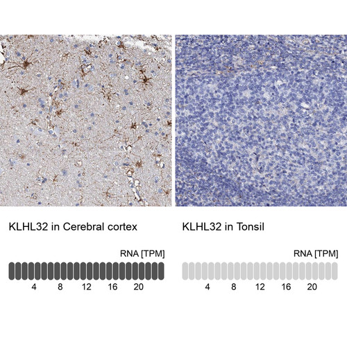 Immunohistochemistry analysis in human cerebral cortex and tonsil tissues using Anti-KLHL32 antibody. Corresponding KLHL32 RNA-seq data are presented for the same tissues.