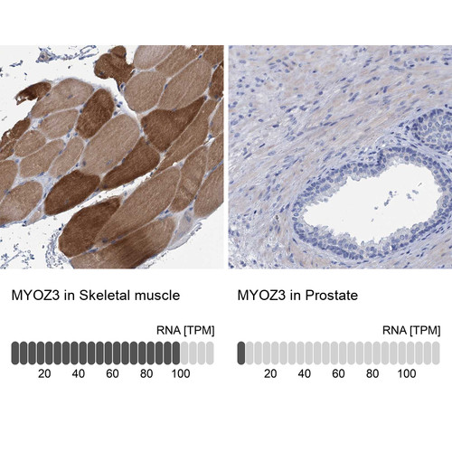 Immunohistochemistry analysis in human skeletal muscle and prostate tissues using Anti-MYOZ3 antibody. Corresponding MYOZ3 RNA-seq data are presented for the same tissues.