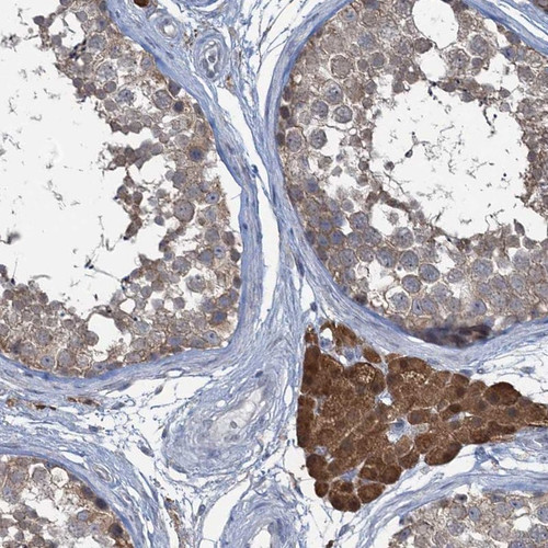 Immunohistochemical staining of human testis shows cytoplasmic positivity in Leydig cells.