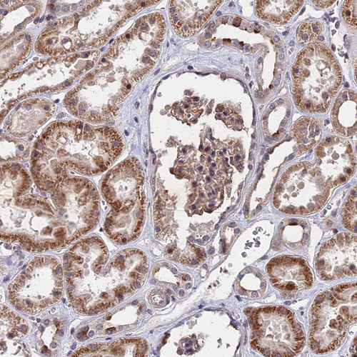 Immunohistochemical staining of human kidney shows moderate cytoplasmic positivity in tubular cells.