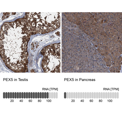 Immunohistochemistry analysis in human testis and pancreas tissues using Anti-PEX5 antibody. Corresponding PEX5 RNA-seq data are presented for the same tissues.