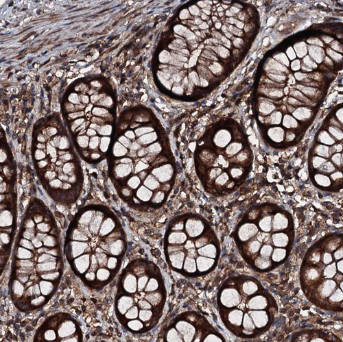 Immunohistochemical staining of human rectum shows very strong cytoplasmic positivity in glandular cells.