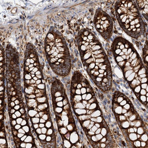 Immunohistochemical staining of human colon shows strong cytoplasmic positivity in glandular cells.