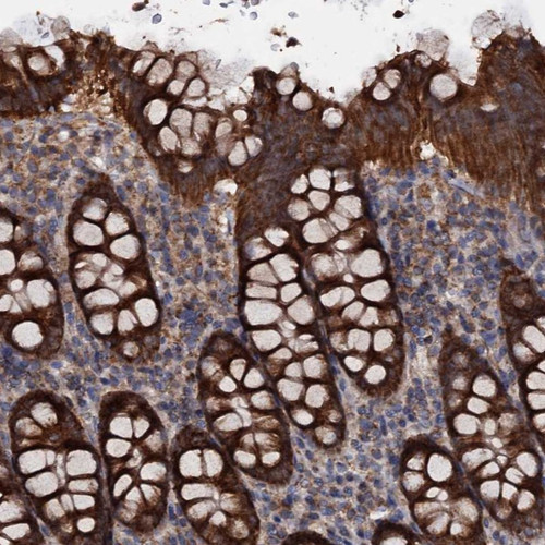 Immunohistochemical staining of human colon shows strong cytoplasmic positivity in glandular cells.