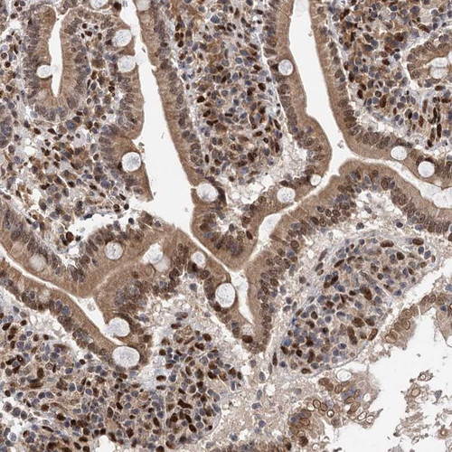 Immunohistochemical staining of human duodenum shows moderate cytoplasmic and nuclear positivity in glandular cells.