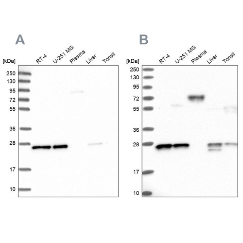 Western blot analysis using Anti-MESDC2 antibody HPA039414 (A) shows similar pattern to independent antibody HPA041721 (B).