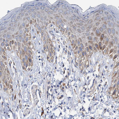 Immunohistochemical staining of human rectum shows moderate cytoplasmic positivity in glandular cells.