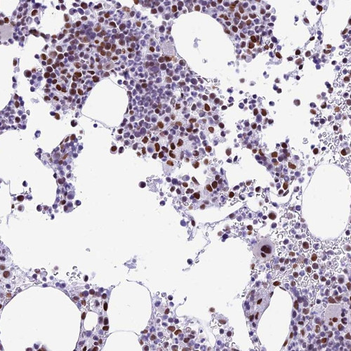 Immunohistochemical staining of human bone marrow shows distinct nuclear positivity in hematopoietic cells.