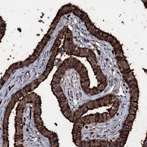 Immunohistochemical staining of human fallopian tube shows strong cytoplasmic positivity in glandular cells.
