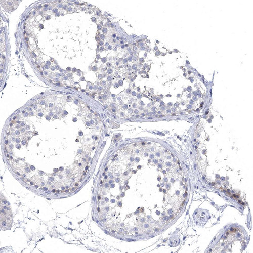 Immunohistochemical staining of human testis shows weak cytoplasmic positivity in spermatogonia.