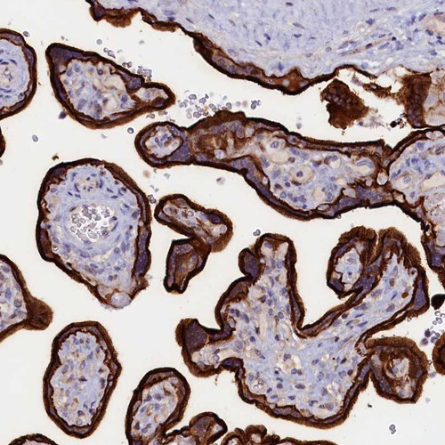 Immunohistochemical staining of human placenta shows strong membranous and cytoplasmic positivity in trophoblastic cells.