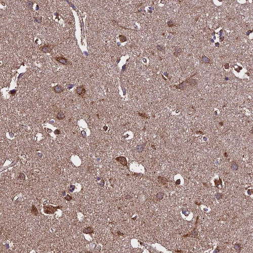 Immunohistochemical staining of human cerebral cortex shows moderate cytoplasmic positivity in neuronal cells.
