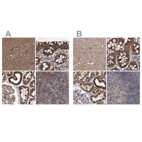 Immunohistochemical staining of human cerebral cortex, colon, kidney and lymph node using Anti-SUCLA2 antibody HPA039536 (A) shows similar protein distribution across tissues to independent antibody HPA039435 (B).