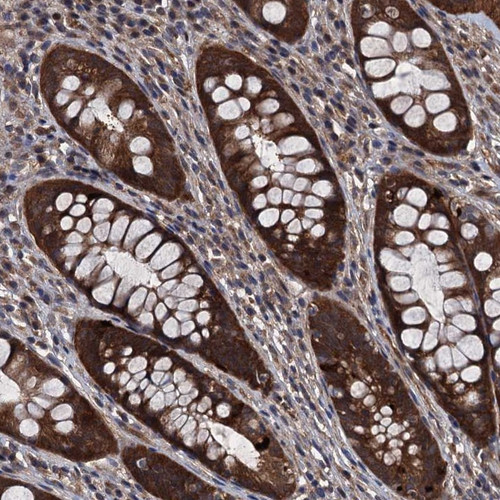 Immunohistochemical staining of human rectum shows strong cytoplasmic positivity in glandular cells.
