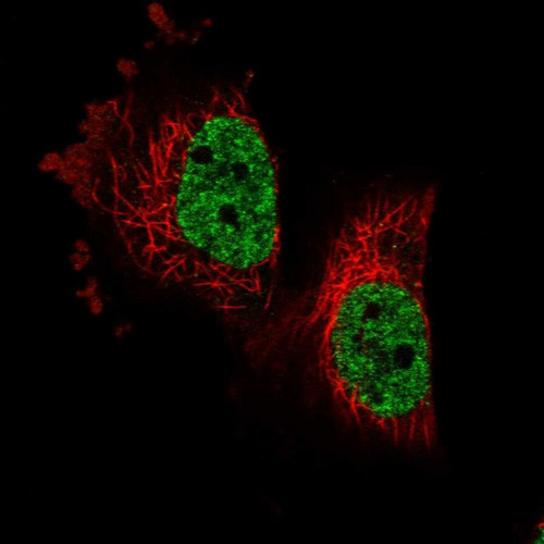 Immunofluorescent staining of human cell line U-251 MG shows localization to nucleoplasm.