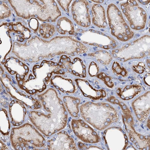 Immunohistochemical staining of human kidney shows strong cytoplasmic positivity in cells in tubules.