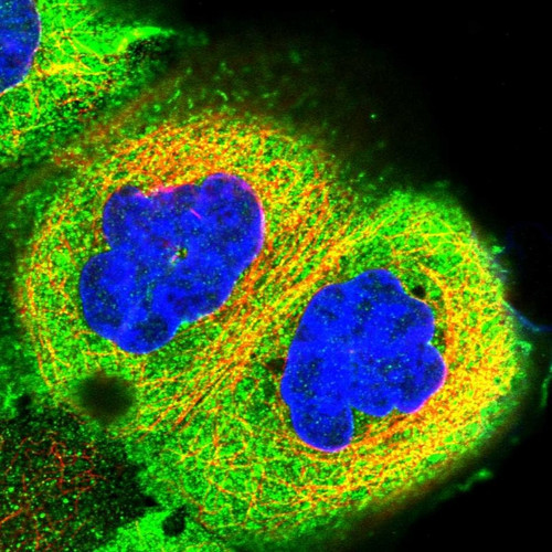 Immunofluorescent staining of human cell line A-431 shows localization to plasma membrane & cytosol.