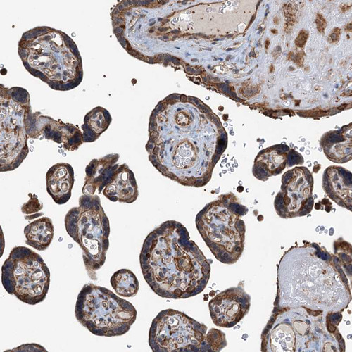 Immunohistochemical staining of human placenta shows strong cytoplasmic positivity in trophoblastic cells.