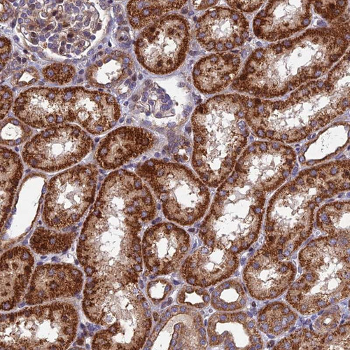 Immunohistochemical staining of human kidney shows strong cytoplasmic positivity in cells in tubules.