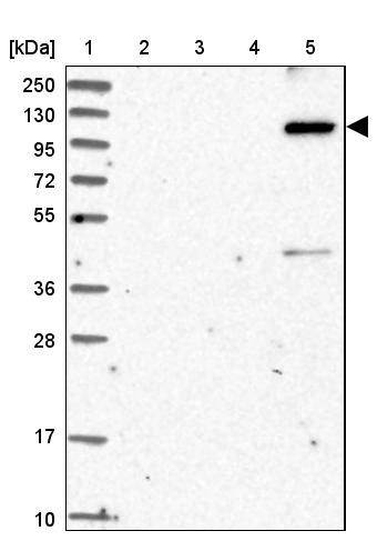 Lane 1: Marker [kDa] 250, 130, 95, 72, 55, 36, 28, 17, 10<br/>Lane 2: Human cell line RT-4<br/>Lane 3: Human cell line U-251MG sp<br/>Lane 4: Human plasma (IgG/HSA depleted)<br/>Lane 5: Human liver tissue