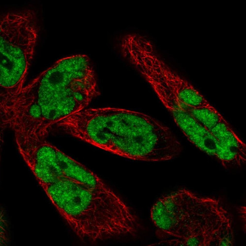 Immunofluorescent staining of human cell line RH-30 shows localization to nucleoplasm.