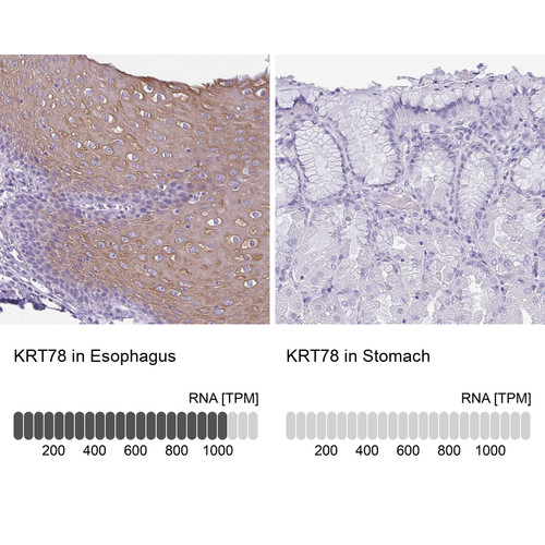 Immunohistochemistry analysis in human esophagus and stomach tissues using HPA039724 antibody. Corresponding KRT78 RNA-seq data are presented for the same tissues.