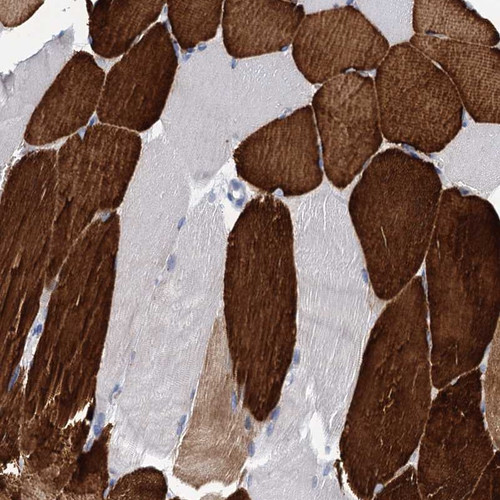 Immunohistochemical staining of human skeletal muscle shows strong cytoplasmic positivity in myocytes.