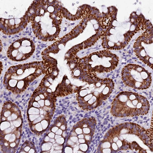 Immunohistochemical staining of human colon shows strong cytoplasmic positivity in glandular cells.