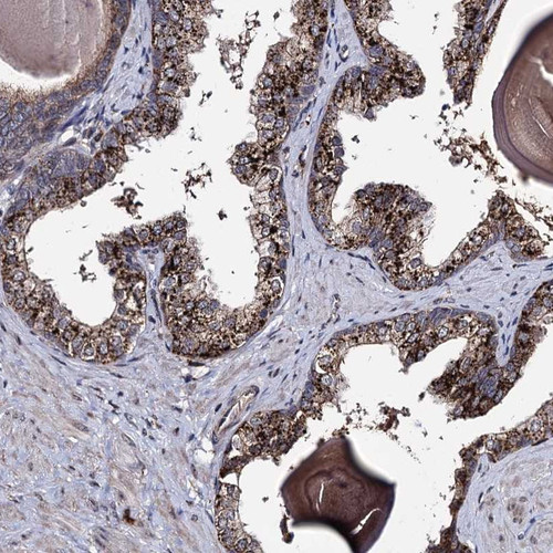 Immunohistochemical staining of human prostate shows strong cytoplasmic positivity in glandular cells.