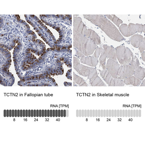 Immunohistochemistry analysis in human fallopian tube and skeletal muscle tissues using Anti-TCTN2 antibody. Corresponding TCTN2 RNA-seq data are presented for the same tissues.