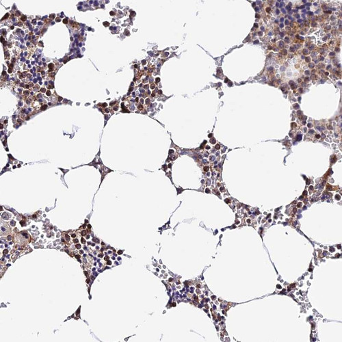 Immunohistochemical staining of human bone marrow shows cytoplasmic positivity in hematopoietic cells.