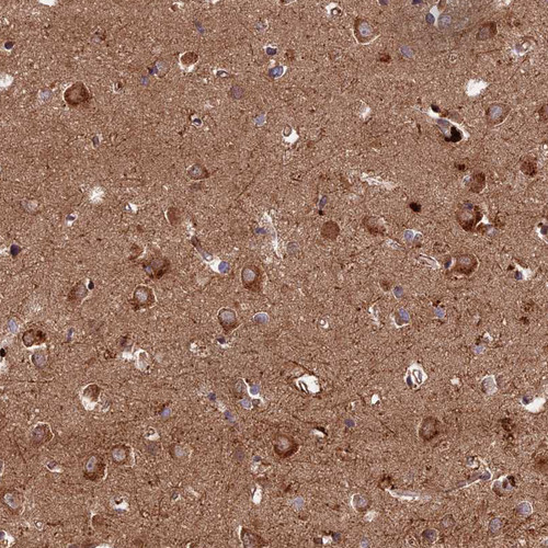 Immunohistochemical staining of human cerebral cortex shows strong granular cytoplasmic positivity in neurons.