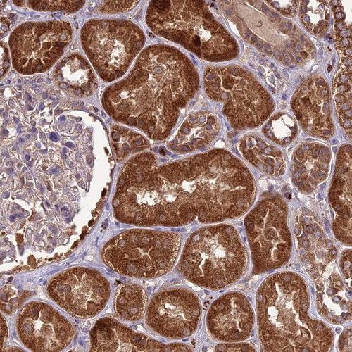 Immunohistochemical staining of human kidney shows strong cytoplasmic positivity in cells in tubules.