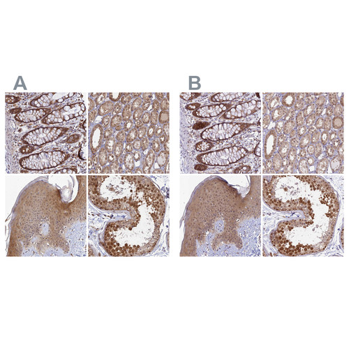 Immunohistochemical staining of human gastrointestinal, kidney, skin and testis using Anti-WDR61 antibody HPA040065 (A) shows similar protein distribution across tissues to independent antibody HPA039932 (B).