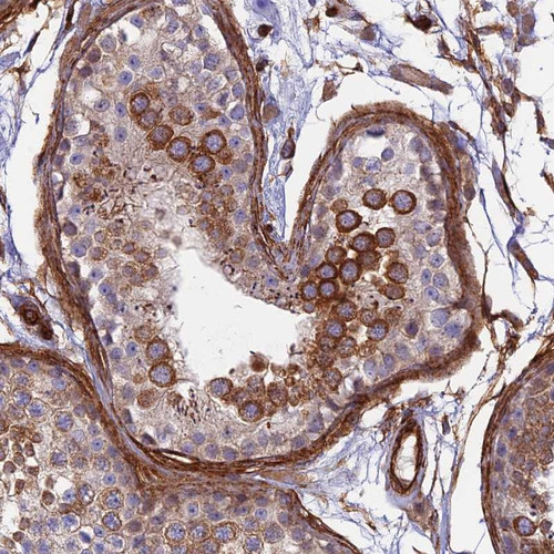 Immunohistochemical staining of human testis shows strong cytoplasmic positivity in cells in seminiferus ducts.