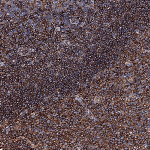 Immunohistochemical staining of human tonsil shows strong cytoplasmic positivity in non-germinal center cells and germinal center cells.