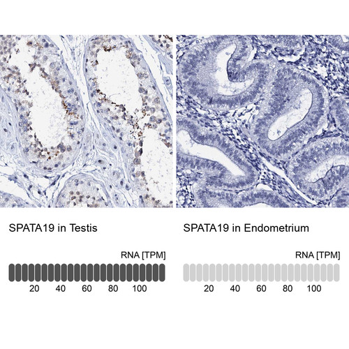 Immunohistochemistry analysis in human testis and endometrium tissues using Anti-SPATA19 antibody. Corresponding SPATA19 RNA-seq data are presented for the same tissues.