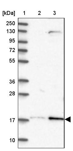 Lane 1: Marker [kDa] 250, 130, 95, 72, 55, 36, 28, 17, 10<br/>Lane 2: Human cell line RT-4<br/>Lane 3: Human cell line U-251MG sp