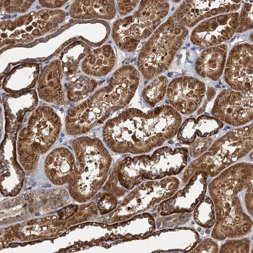 Immunohistochemical staining of human kidney shows strong cytoplasmic positivity in tubular cells.