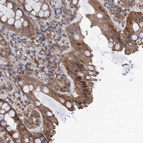 Immunohistochemical staining of human rectum shows moderate cytoplasmic and nuclear positivity in glandular cells.