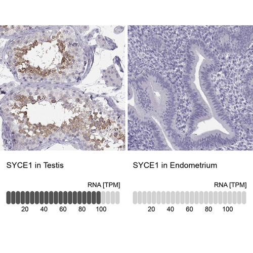 Immunohistochemistry analysis in human testis and endometrium tissues using Anti-SYCE1 antibody. Corresponding SYCE1 RNA-seq data are presented for the same tissues.