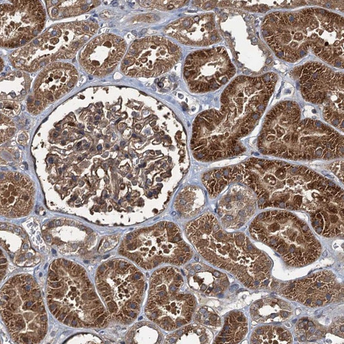 Immunohistochemical staining of human kidney shows strong cytoplasmic positivity in cells in tubules and in glomeruli. Immunohistochemical staining of human kidney shows strong cytoplasmic positivity in cells in tubules and in glomeruli.