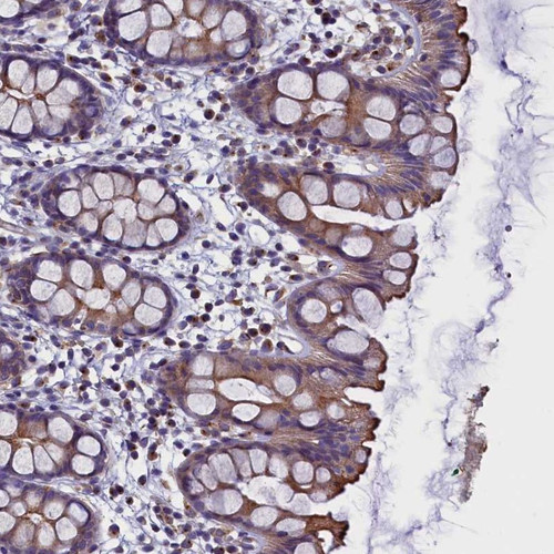Immunohistochemical staining of human rectum shows moderate cytoplasmic and membranous positivity in glandular cells.