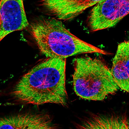 Immunofluorescent staining of human cell line U-251 MG shows localization to cytosol.