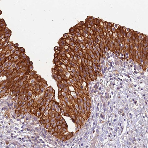 Immunohistochemical staining of human urinary bladder shows strong cytoplasmic and membranous positivity in urothelial cells.