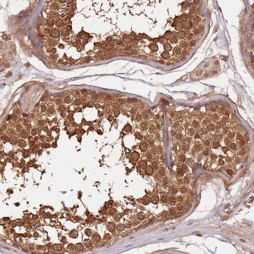 Immunohistochemical staining of human testis shows strong cytoplasmic and nuclear positivity in cells in seminiferus ducts.