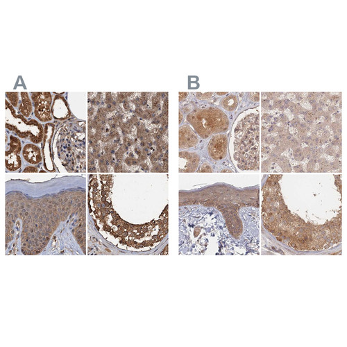 Immunohistochemical staining of human kidney, liver, skin and testis using Anti-PSMD9 antibody HPA040512 (A) shows similar protein distribution across tissues to independent antibody HPA044220 (B).